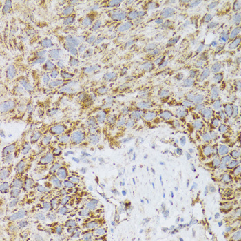 Immunohistochemistry - PDYN Polyclonal Antibody 