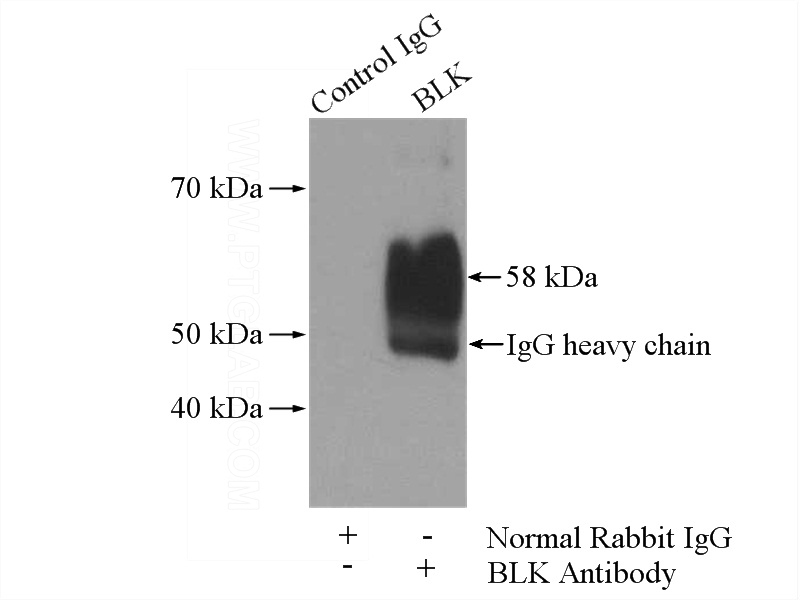 IP Result of anti-BLK (IP:Catalog No:117185, 4ug; Detection:Catalog No:117185 1:500) with SH-SY5Y cells lysate 1600ug.