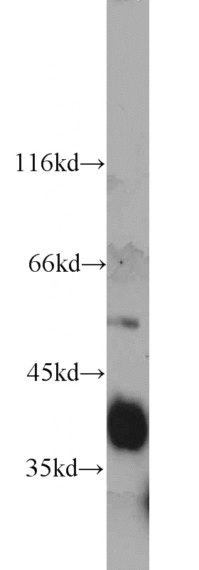 human liver tissue were subjected to SDS PAGE followed by western blot with Catalog No:108226(ASGR1 antibody) at dilution of 1:500