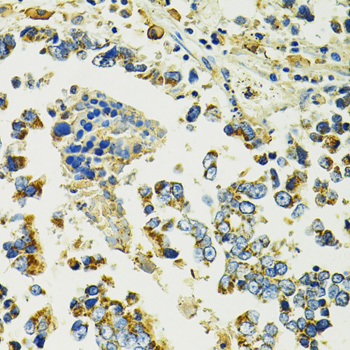 Immunohistochemistry - SLC25A11 Polyclonal Antibody 