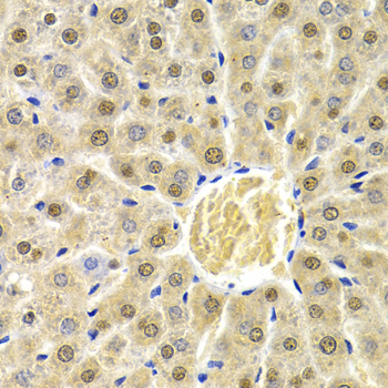 Immunohistochemistry - RAD9A Polyclonal Antibody 