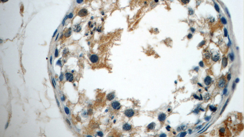 Immunohistochemistry of paraffin-embedded human testis tissue slide using Catalog No:112532(MFSD2 Antibody) at dilution of 1:50 (under 40x lens)