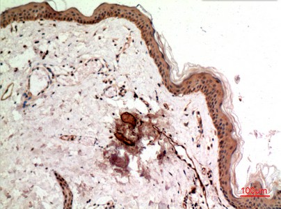 Fig2:; Immunohistochemical analysis of paraffin-embedded human-skin, antibody was diluted at 1:100