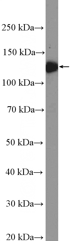 human blood tissue were subjected to SDS PAGE followed by western blot with Catalog No:109121(ITGA2B Antibody) at dilution of 1:3000