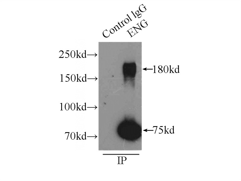 IP Result of anti-ENG (IP:Catalog No:110248, 3ug; Detection:Catalog No:110248 1:300) with mouse lung tissue lysate 4000ug.