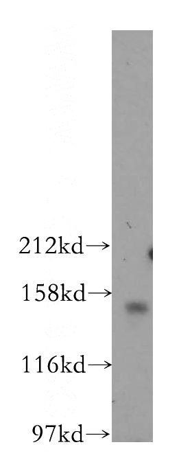 MCF7 cells were subjected to SDS PAGE followed by western blot with Catalog No:113582(PARD3 antibody) at dilution of 1:300