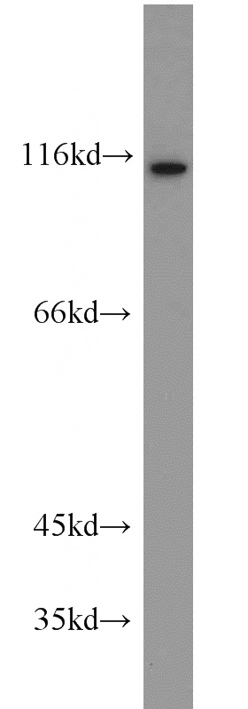 mouse thymus tissue were subjected to SDS PAGE followed by western blot with Catalog No:110702(FOXM1 antibody) at dilution of 1:1000