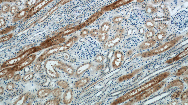 Immunohistochemistry of paraffin-embedded human kidney slide using Catalog No:112904(MUTYH Antibody) at dilution of 1:50