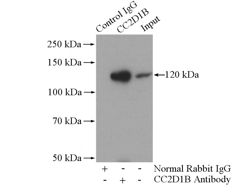 IP Result of anti-CC2D1B (IP:Catalog No:108952, 4ug; Detection:Catalog No:108952 1:500) with mouse brain tissue lysate 2560ug.