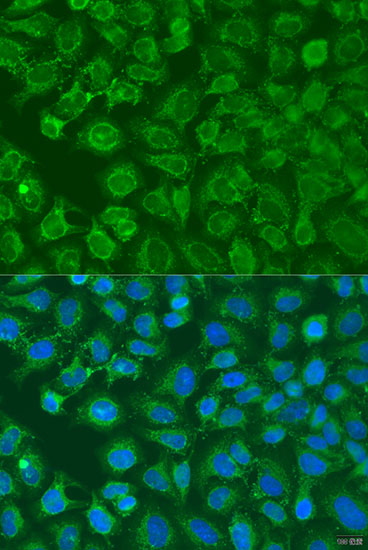 Immunofluorescence - EIF2B1 Polyclonal Antibody 