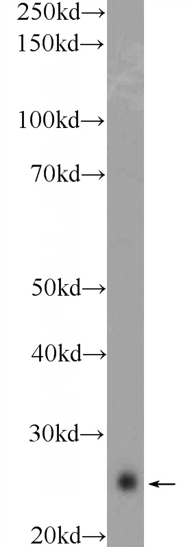 SH-SY5Y cells were subjected to SDS PAGE followed by western blot with Catalog No:115211(SERTAD1 Antibody) at dilution of 1:1000