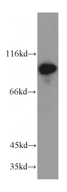 mouse skin tissue were subjected to SDS PAGE followed by western blot with Catalog No:107897(AVIL antibody) at dilution of 1:300