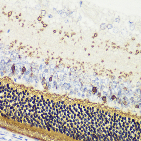 Immunohistochemistry - RCVRN Polyclonal Antibody 