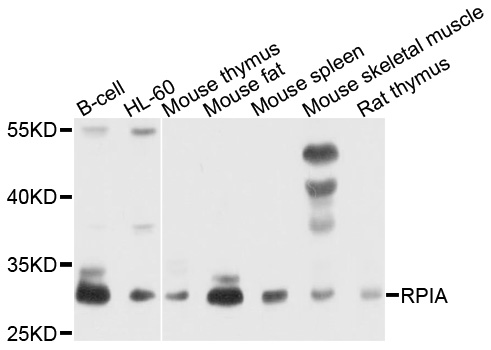 Western blot - RPIA Polyclonal Antibody 