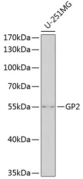Western blot - GP2 Polyclonal Antibody 