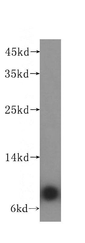 human liver tissue were subjected to SDS PAGE followed by western blot with Catalog No:108356(ATP5I antibody) at dilution of 1:300