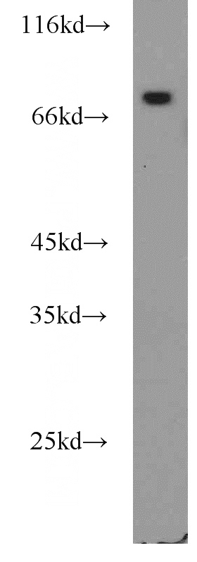rat heart tissue were subjected to SDS PAGE followed by western blot with Catalog No:111588(ICAM-1 antibody) at dilution of 1:800
