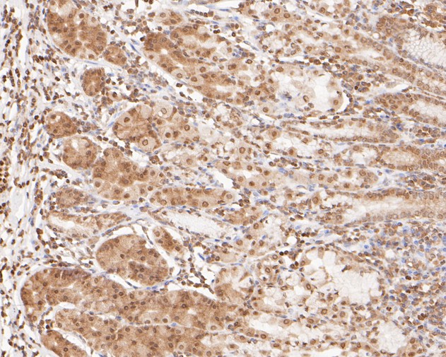 Fig3:; Immunohistochemical analysis of paraffin-embedded human stomach tissue using anti-OC-3 antibody. The section was pre-treated using heat mediated antigen retrieval with sodium citrate buffer (pH 6.0) for 20 minutes. The tissues were blocked in 5% BSA for 30 minutes at room temperature, washed with ddH; 2; O and PBS, and then probed with the primary antibody ( 1/400) for 30 minutes at room temperature. The detection was performed using an HRP conjugated compact polymer system. DAB was used as the chromogen. Tissues were counterstained with hematoxylin and mounted with DPX.