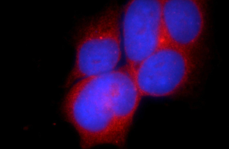 Immunofluorescent analysis of HEK-293 cells using Catalog No:108635(C10orf68 Antibody) at dilution of 1:25 and Rhodamine-Goat anti-Rabbit IgG