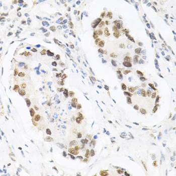 Immunohistochemistry - KPNA4 Polyclonal Antibody 
