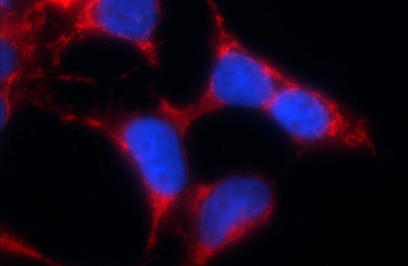 Immunofluorescent analysis of HEK-293 cells using Catalog No:112034(GLS Antibody) at dilution of 1:25 and Rhodamine-Goat anti-Rabbit IgG
