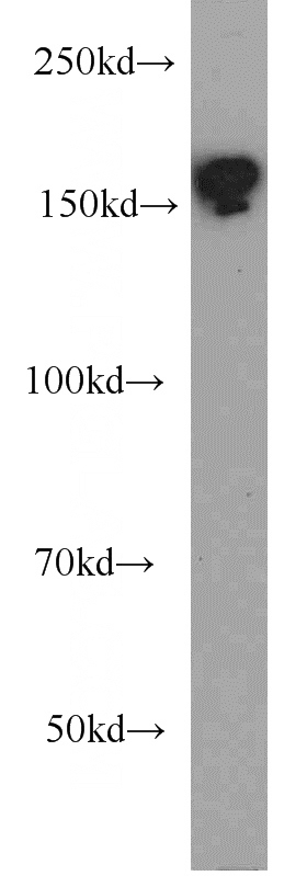 HeLa cells were subjected to SDS PAGE followed by western blot with Catalog No:108405(SMARCC2 antibody) at dilution of 1:500