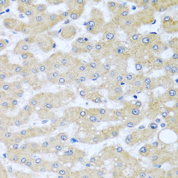 Immunohistochemistry - BCKDK Polyclonal Antibody 