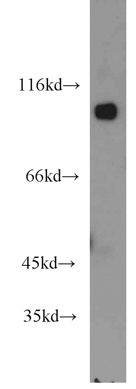 mouse testis tissue were subjected to SDS PAGE followed by western blot with Catalog No:109725(CTNNA3 antibody) at dilution of 1:1500