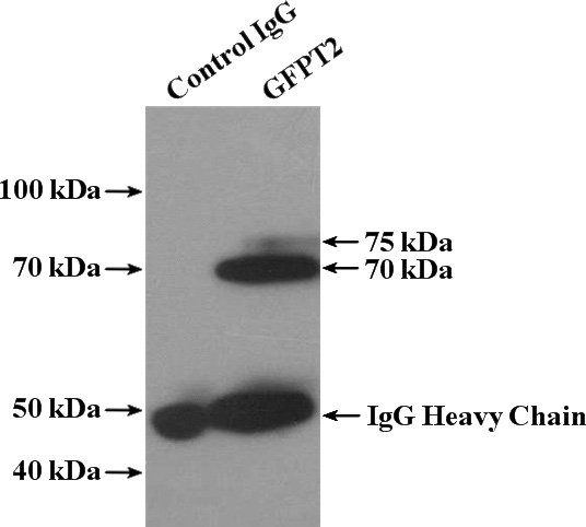 IP Result of anti-GFPT2 (IP:Catalog No:110952, 4ug; Detection:Catalog No:110952 1:300) with HT-1080 cells lysate 2400ug.