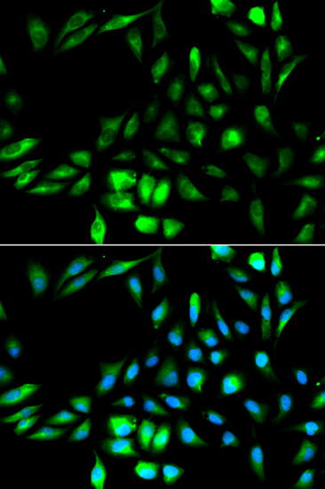 Immunofluorescence - KPNA2 Polyclonal Antibody 