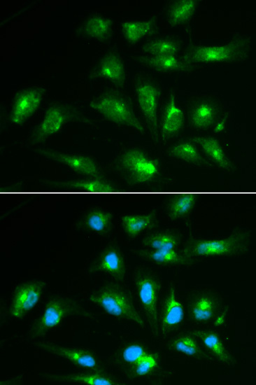 Immunofluorescence - CD46 Polyclonal Antibody 