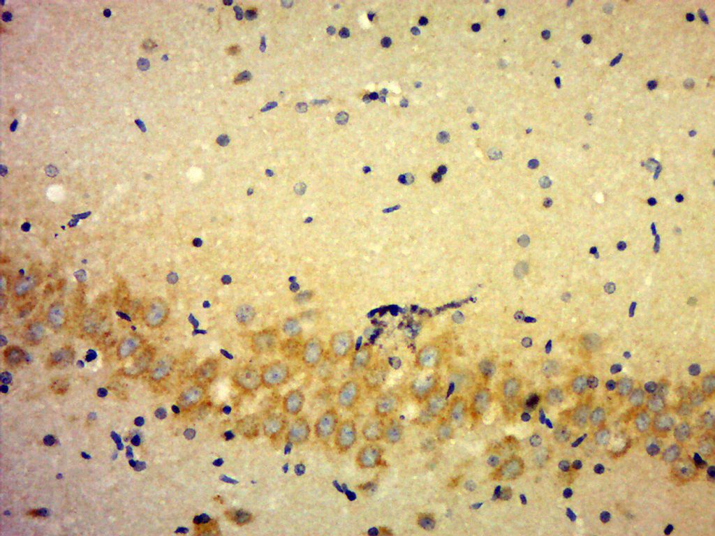 Fig2: Paraformaldehyde-fixed, paraffin embedded (Rat brain); Antigen retrieval by boiling in sodium citrate buffer (pH6.0) for 15min; Block endogenous peroxidase by 3% hydrogen peroxide for 20 minutes; Blocking buffer (normal goat serum) at 37℃ for 30min; Antibody incubation with (KLHDC7B) Polyclonal Antibody, Unconjugated at 1:500 overnight at 4℃, followed by a conjugated secondary (sp-0023) for 20 minutes and DAB staining.