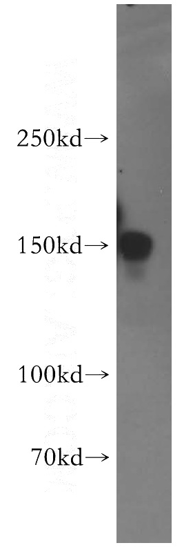 HeLa cells were subjected to SDS PAGE followed by western blot with Catalog No:117261(TJP2 antibody) at dilution of 1:500