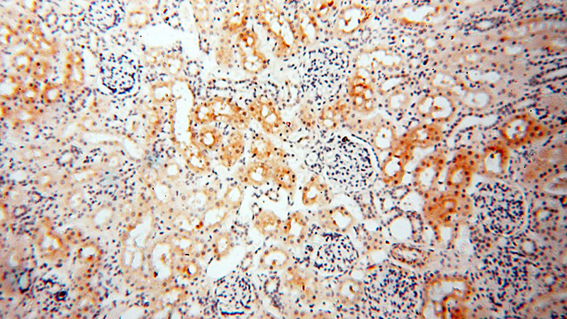 Immunohistochemical of paraffin-embedded human kidney using Catalog No:114118(PPCS antibody) at dilution of 1:100 (under 10x lens)