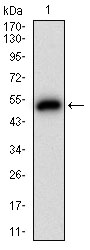Western blot analysis using GAB2 mAb against human GAB2 (AA