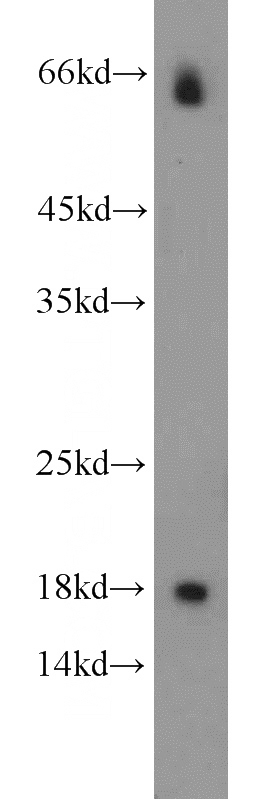 human heart tissue were subjected to SDS PAGE followed by western blot with Catalog No:115499(SST-Specific antibody) at dilution of 1:500