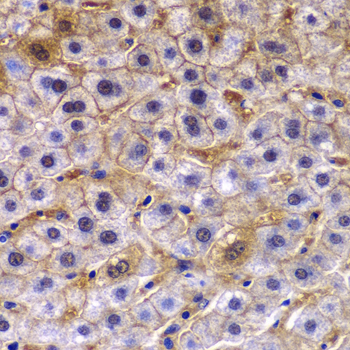 Immunohistochemistry - TCTN3 Polyclonal Antibody 