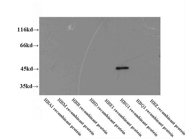 WB results of Catalog No:111269 (HBG1 antibody) at dilution of 1:2000.