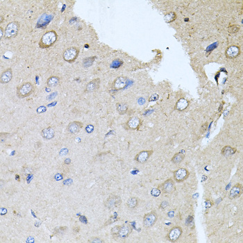 Immunohistochemistry - RARA Polyclonal Antibody 