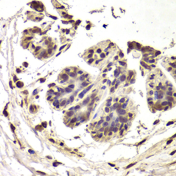 Immunohistochemistry - INTS6 Polyclonal Antibody 