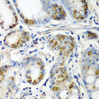 Immunohistochemistry - CRYAA Polyclonal Antibody 