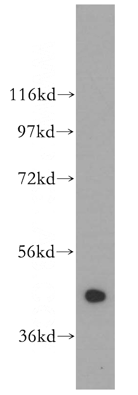 human brain tissue were subjected to SDS PAGE followed by western blot with Catalog No:107772(ADAP1 antibody) at dilution of 1:1000