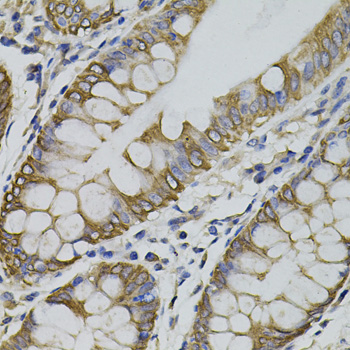Immunohistochemistry - ARHGEF11 Polyclonal Antibody 