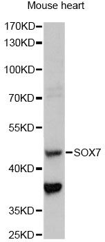 Western blot - SOX7 Polyclonal Antibody 