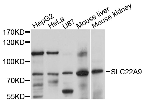Western blot - SLC22A9 Polyclonal Antibody 
