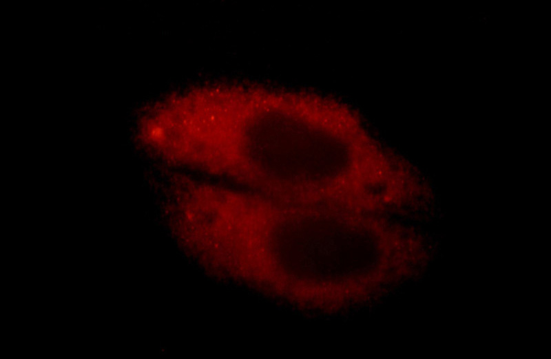 Immunofluorescent analysis of HepG2 cells, using IL5RA antibody Catalog No:111746 at 1:25 dilution and Rhodamine-labeled goat anti-rabbit IgG (red).