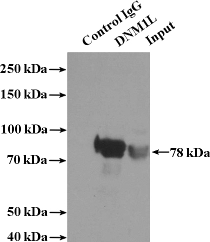 IP Result of anti-DNM1L,DLP1 (IP:Catalog No:109962, 4ug; Detection:Catalog No:109962 1:500) with mouse brain tissue lysate 4000ug.