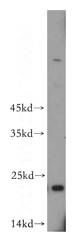 mouse pancreas tissue were subjected to SDS PAGE followed by western blot with Catalog No:116085(TMED2 antibody) at dilution of 1:500