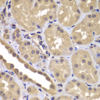 Immunohistochemistry - BAG2 Polyclonal Antibody 
