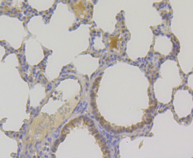 Fig7:; Immunohistochemical analysis of paraffin-embedded mouse lung tissue using anti-TNPO3 antibody. The section was pre-treated using heat mediated antigen retrieval with sodium citrate buffer (pH 6.0) for 20 minutes. The tissues were blocked in 5% BSA for 30 minutes at room temperature, washed with ddH; 2; O and PBS, and then probed with the primary antibody ( 1/50) for 30 minutes at room temperature. The detection was performed using an HRP conjugated compact polymer system. DAB was used as the chromogen. Tissues were counterstained with hematoxylin and mounted with DPX.